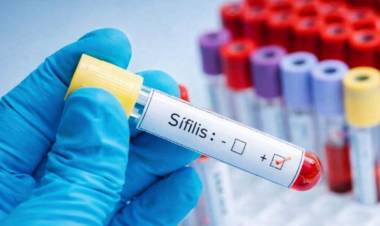 SE DISPARÓ EL NÚMERO DE CASOS DE SÍFILIS EN LA ARGENTINA