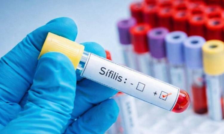 SE DISPARÓ EL NÚMERO DE CASOS DE SÍFILIS EN LA ARGENTINA